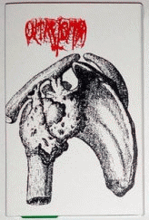 Oltretomba (DK) : Matière Fecale - Scorbut